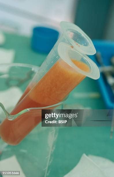 pic of a dick|178 Penile Stock Photos & High